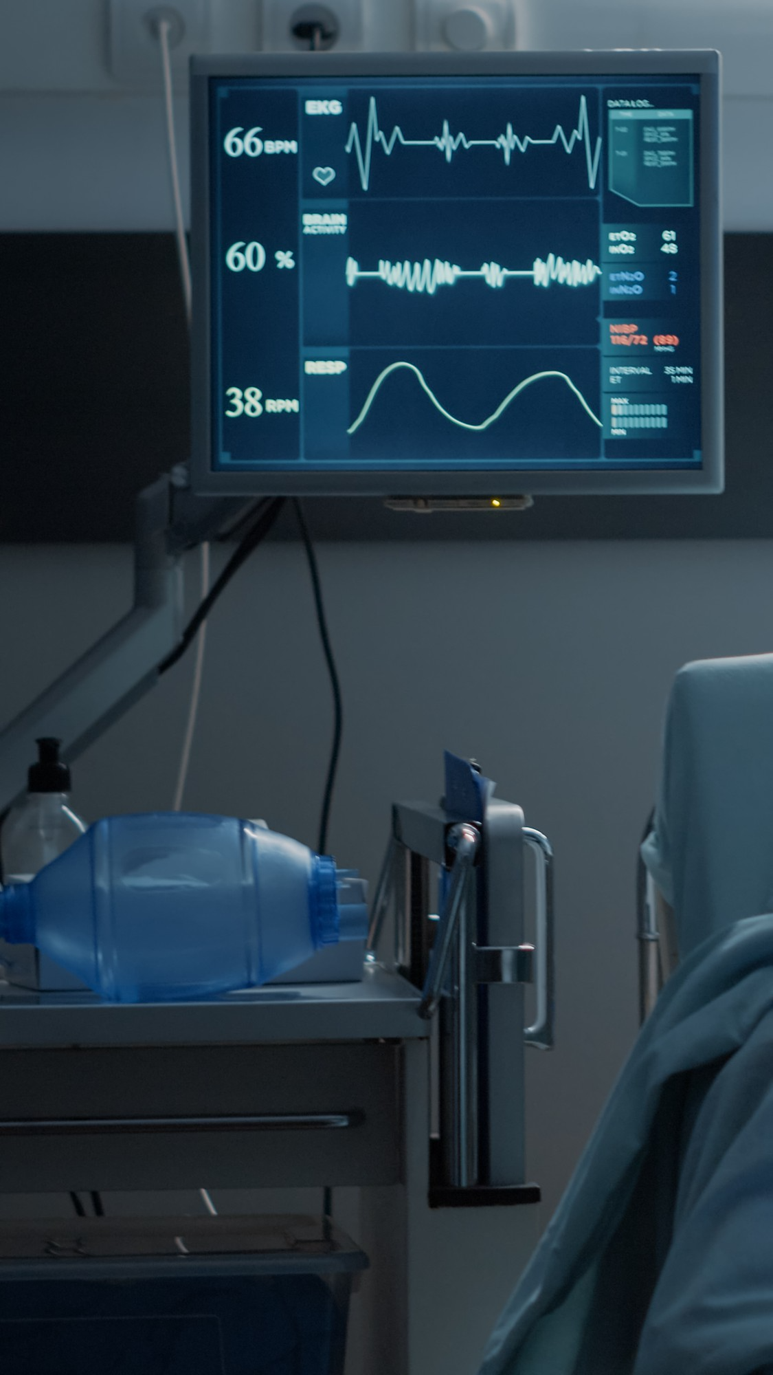 ECG