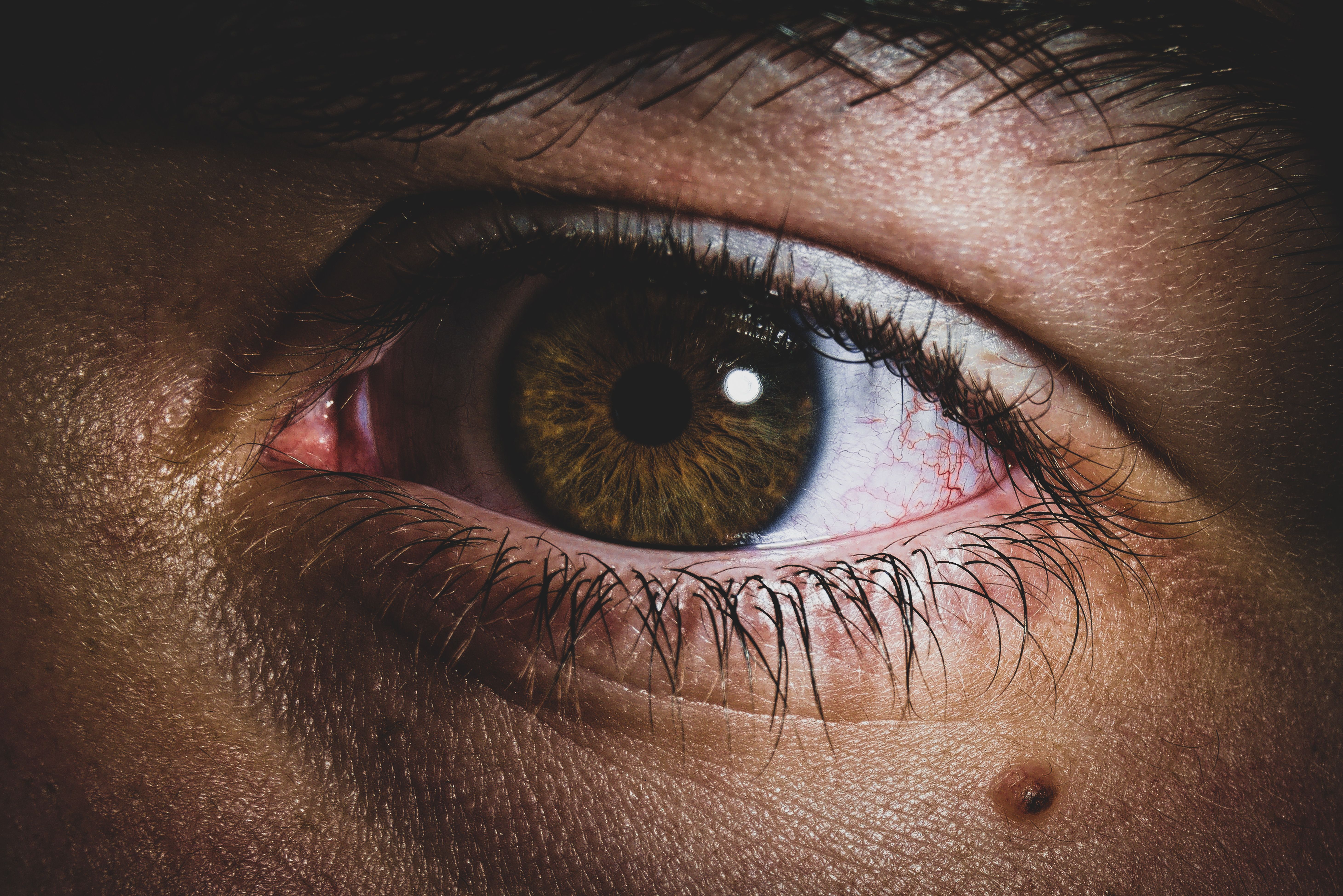 How to Cure Apollo Eye Disease Fast?