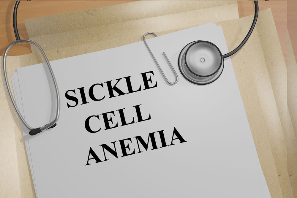 NJ Sickle Cell Anemia Attorneys