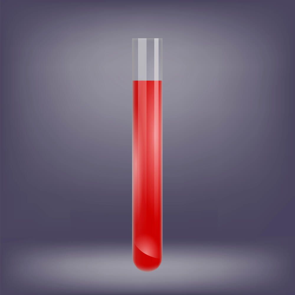 The Purpose and Implications of Blood Gas Testing After Birth