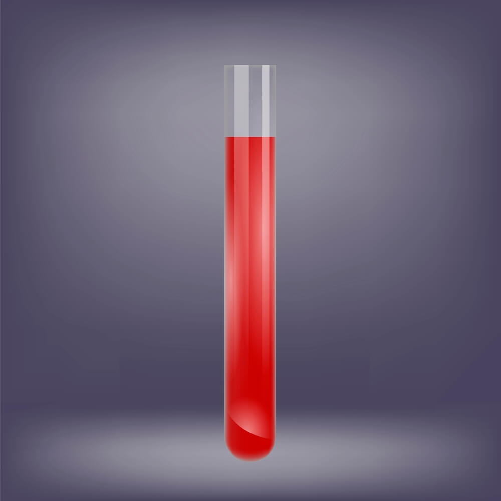 The Purpose and Implications of Blood Gas Testing After Birth