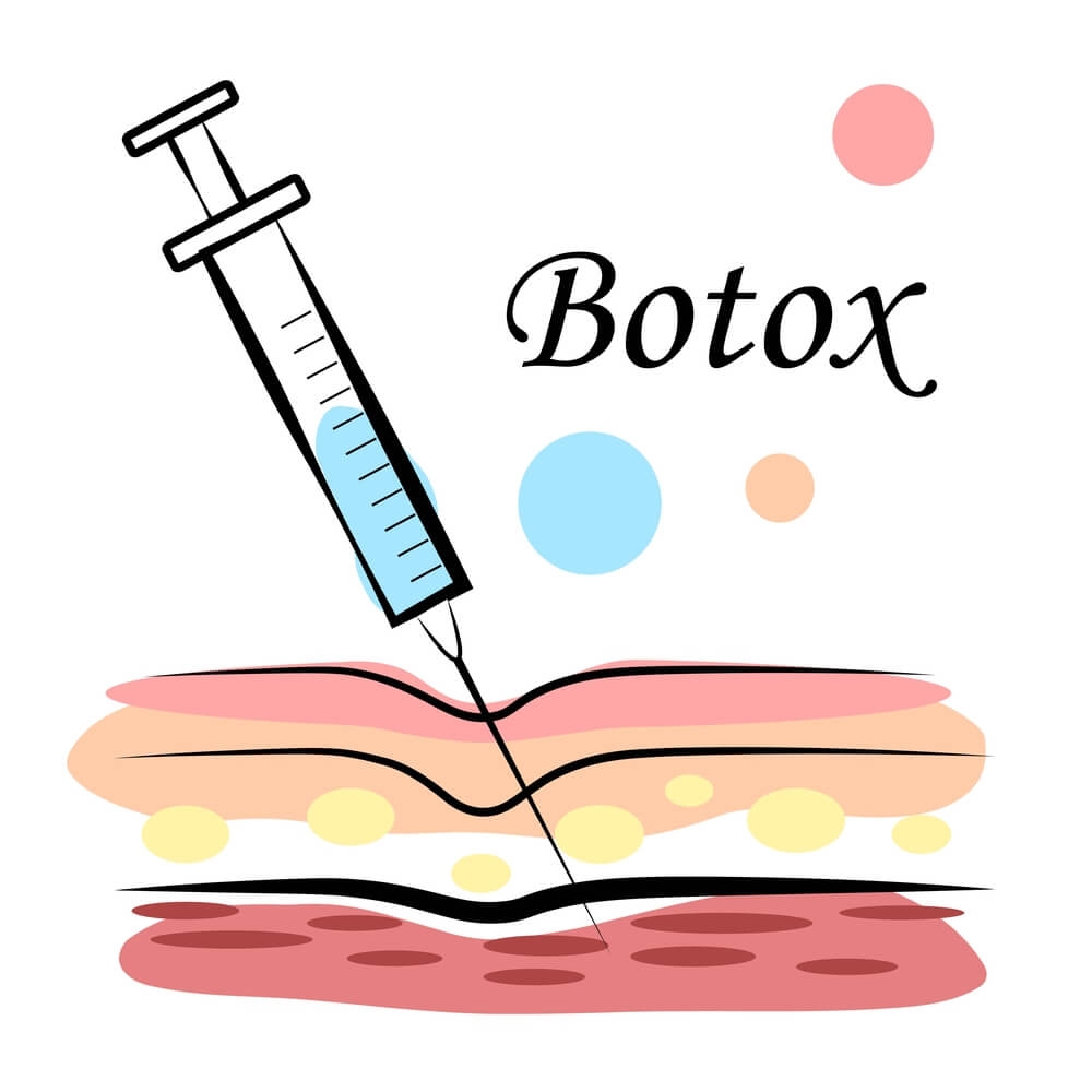 Utility of Botox for Birth Injury and Cerebral Palsy