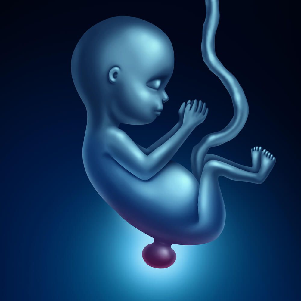 Spina Bifida and Negligence
