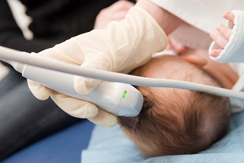 How Infant Strokes Affect the Brain