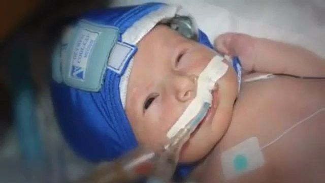 Cooling Therapy for Newborn Brain Injuries