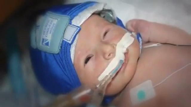Cooling Therapy for Newborn Brain Injuries