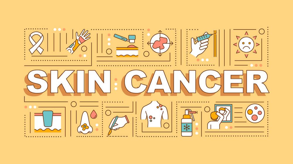 Sunburns, Children, and Skin Cancer: What Happens if Your Child is Misdiagnosed