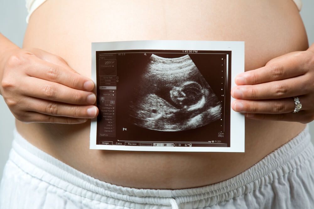 New Information about Maternal Mortality in the US