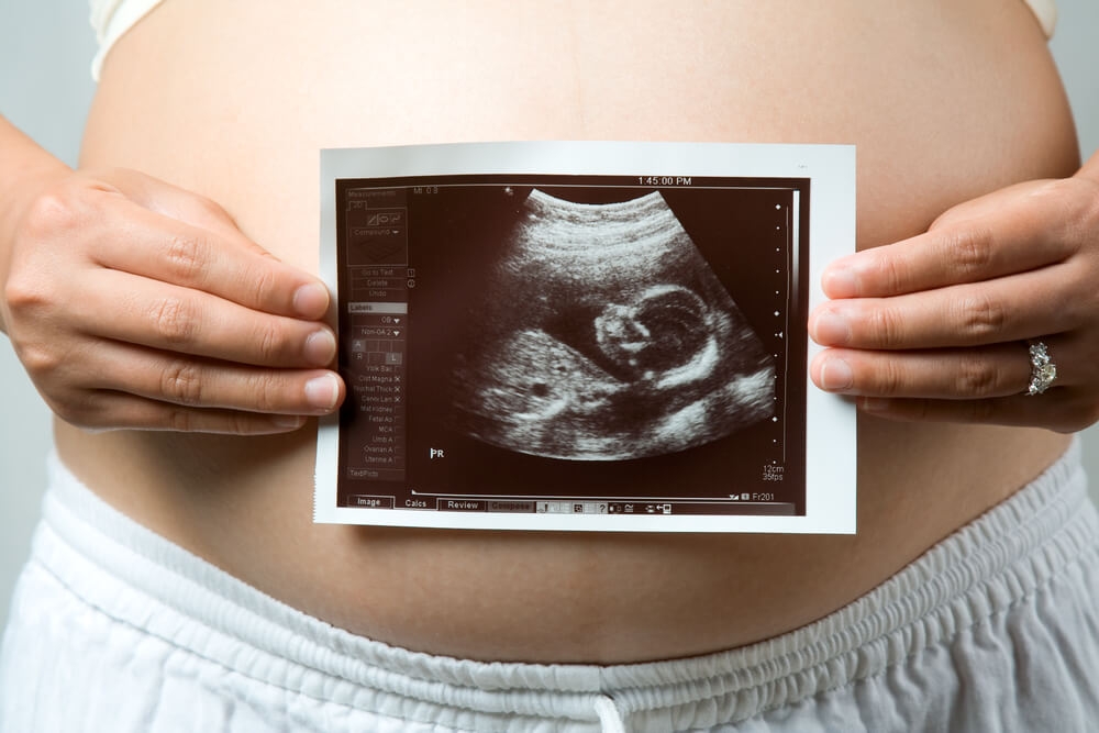 New Information about Maternal Mortality in the US