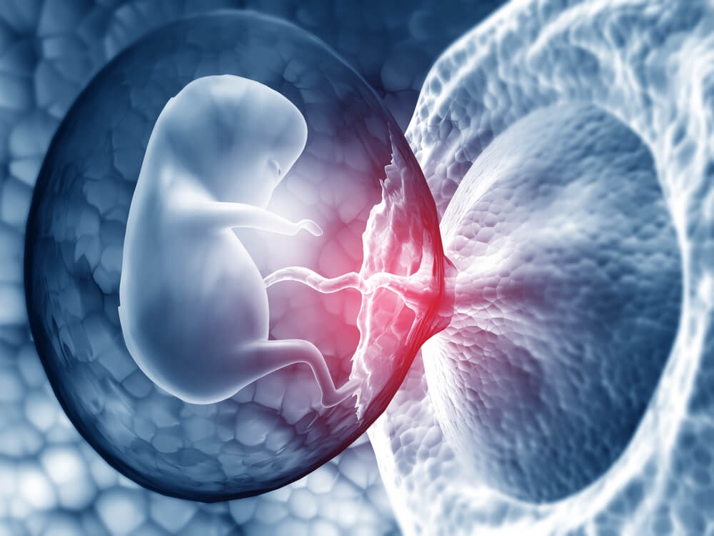 Your Rights in Marginal Umbilical Cord Insertion Claims