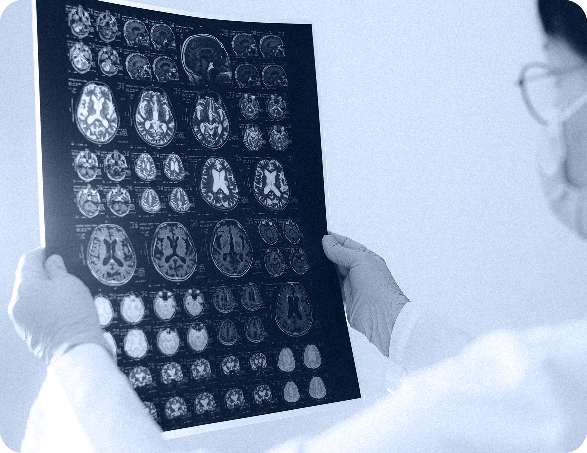 Child Brain Injuries