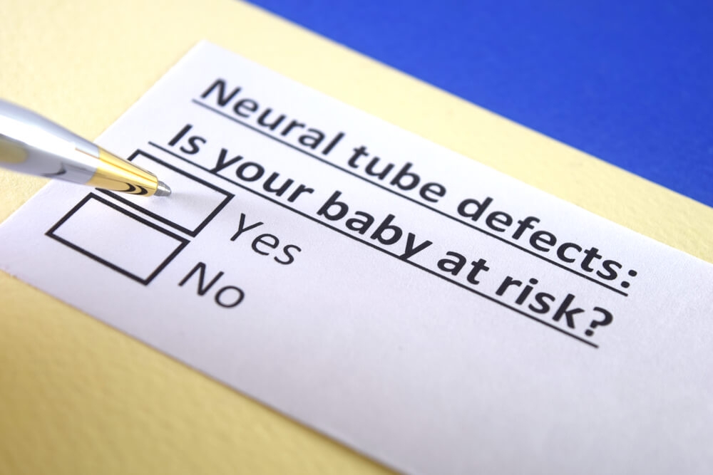 Anencephaly Lawsuits