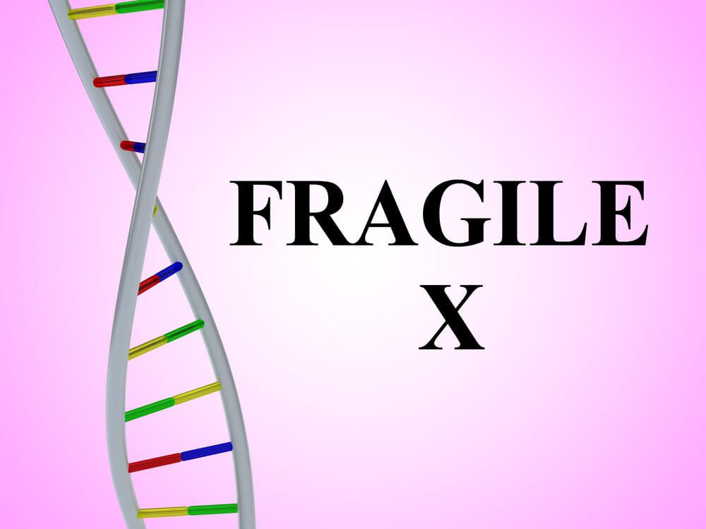 When Fragile X Syndrome Malpractice Happens to Your Child