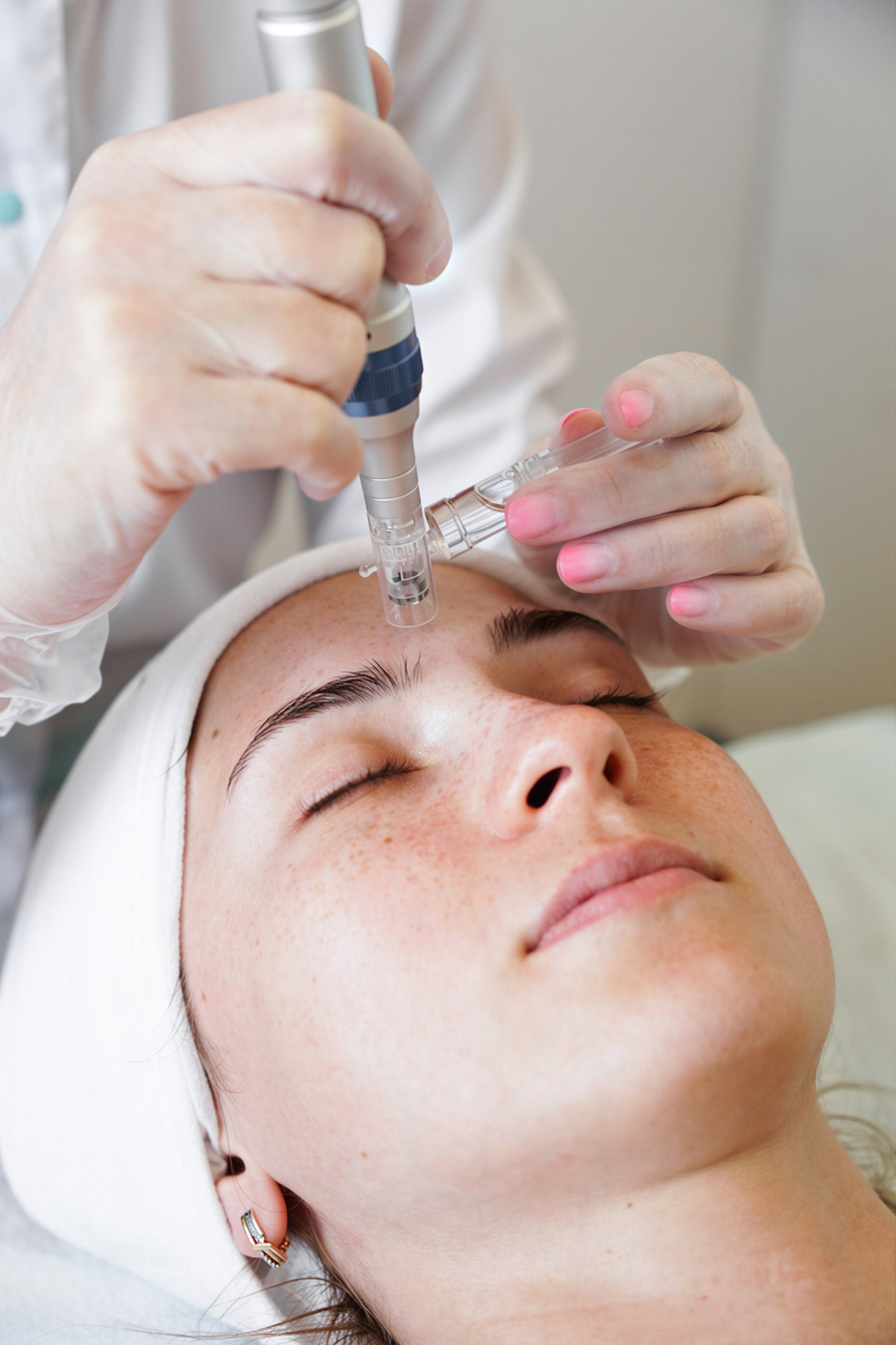 Microneedling Procedures