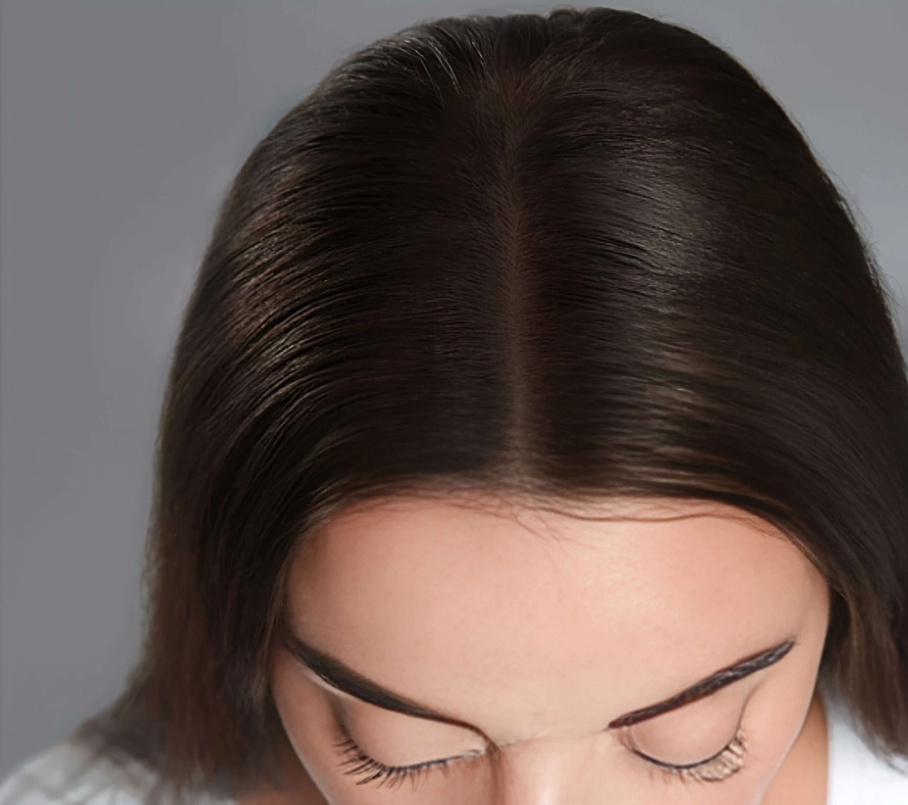 Hair wellness procedures After