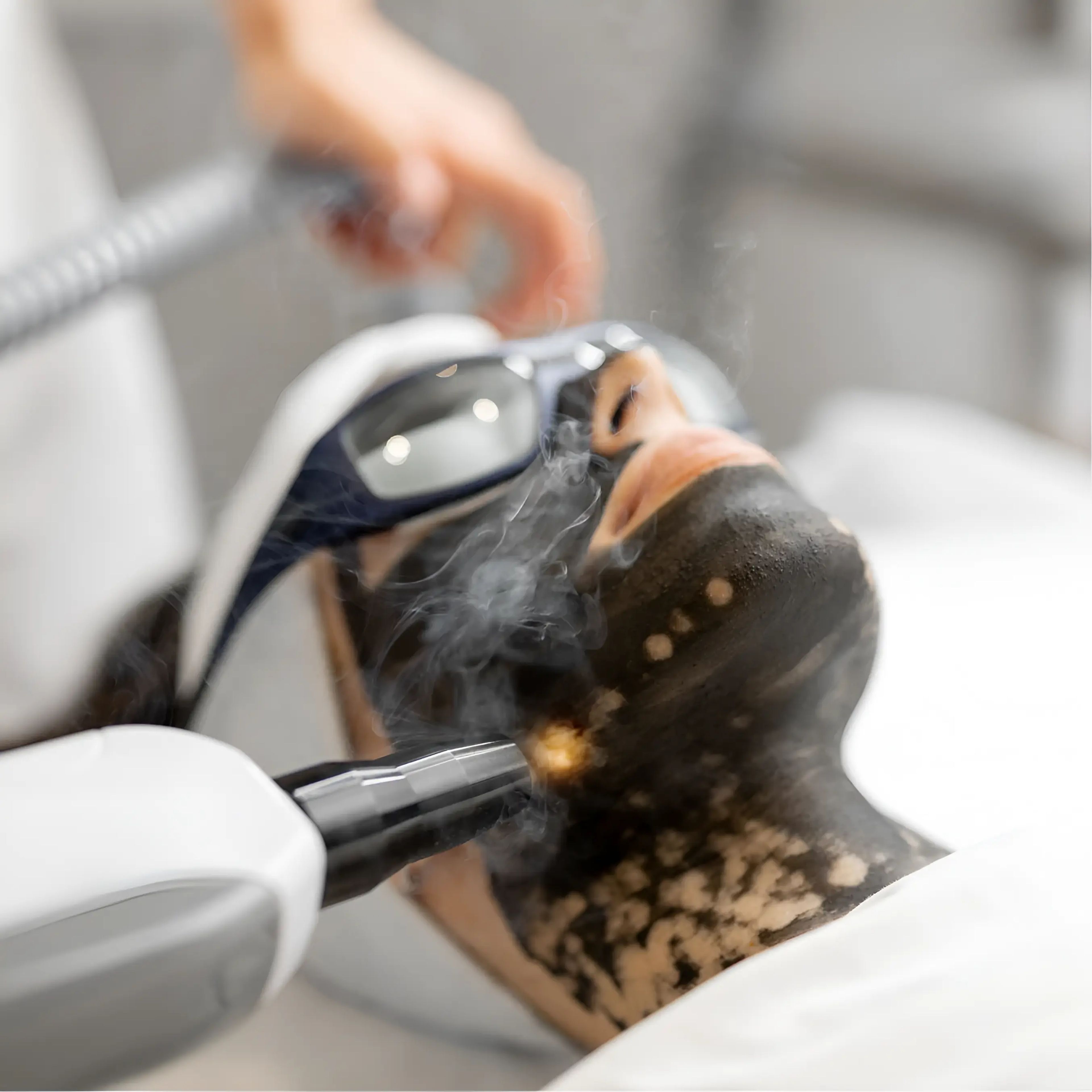 Advanced Carbon Laser Facial for Clearer, Smoother, and Radiant Skin at Snowvique Wellness Studio in Melbourne