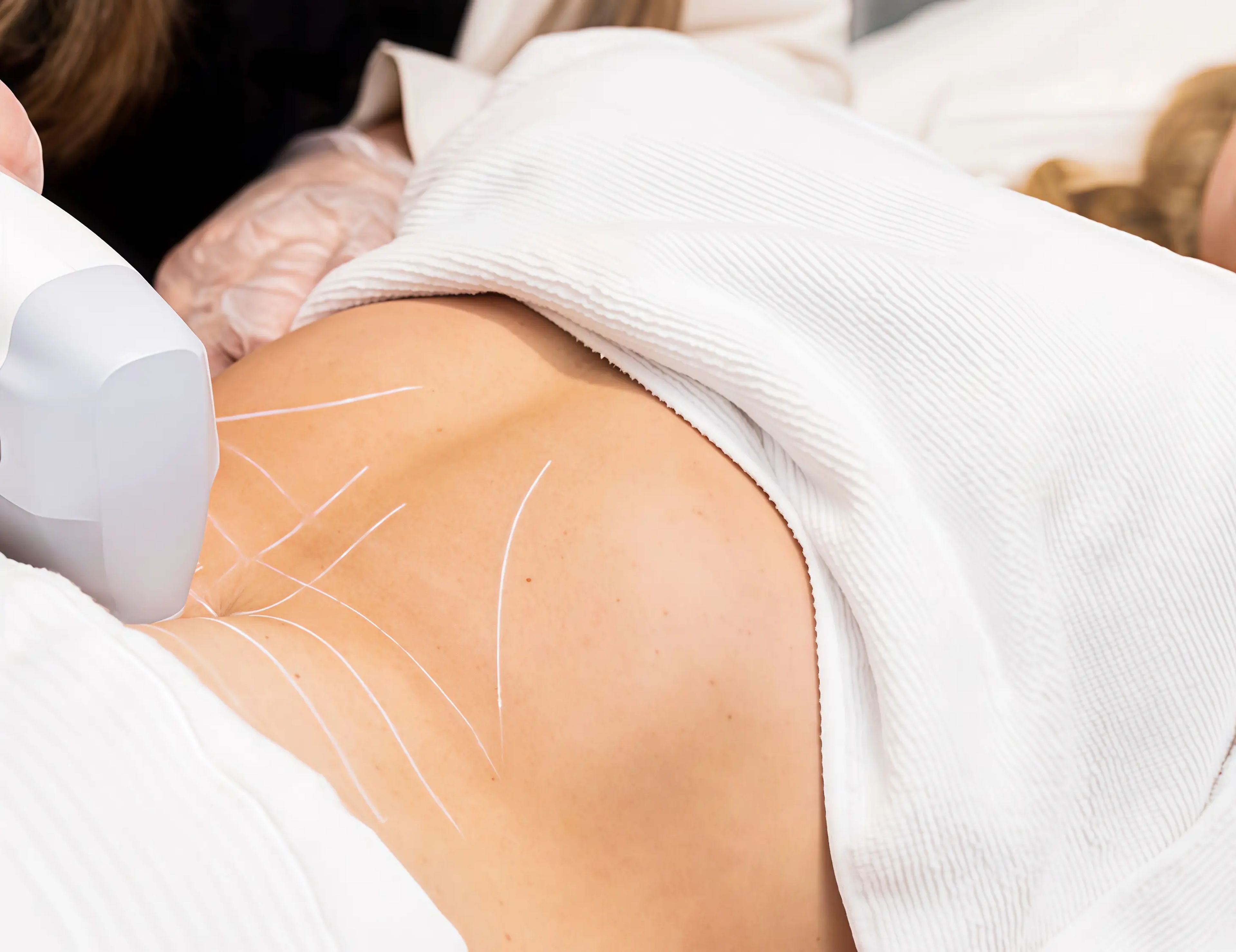 Non-Invasive Body Contouring for Toning, Shaping & Sculpting Results at Snowvique Wellness Studio in Melbourne