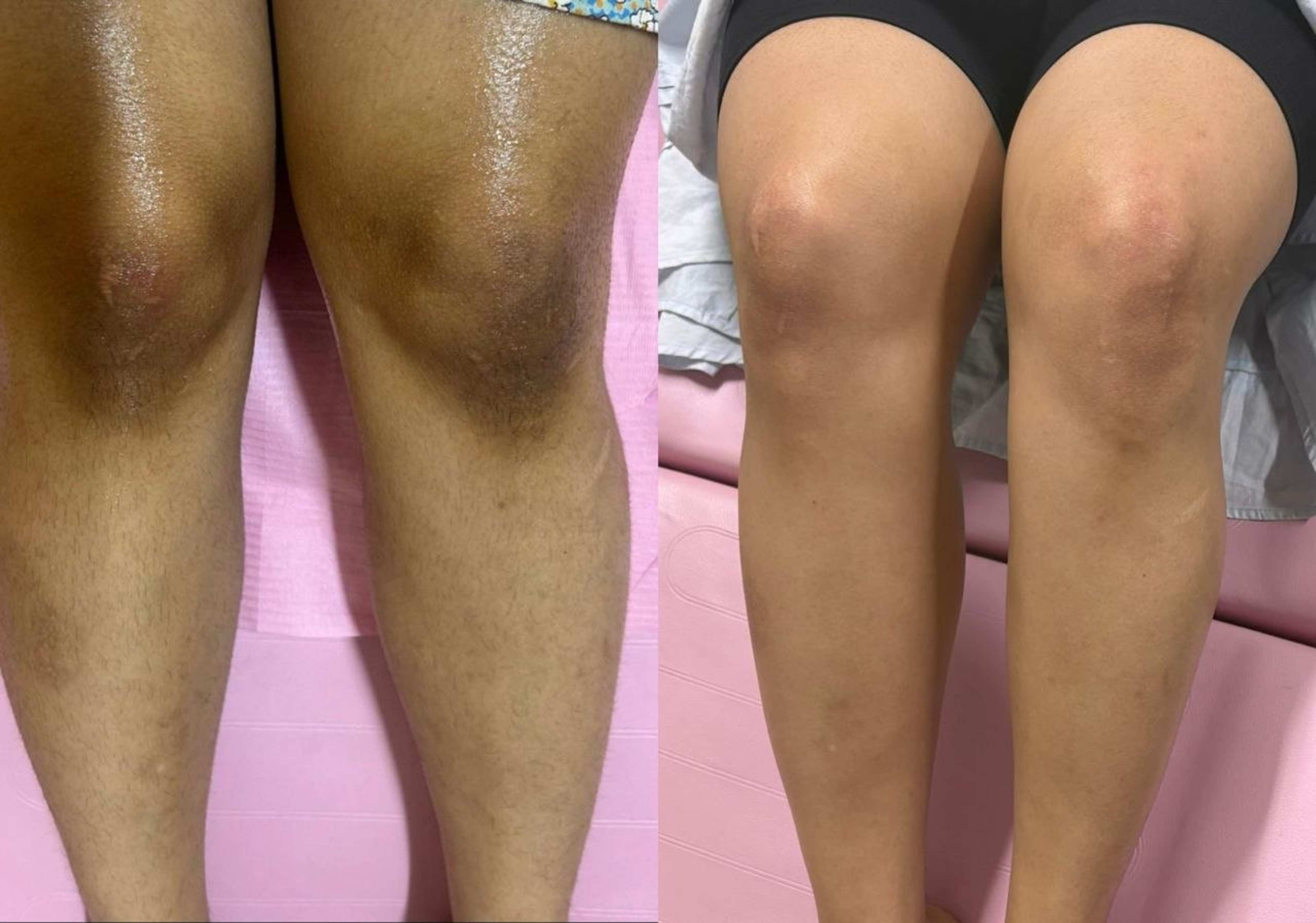 Even Skin Tone & Dark Spot Reduction