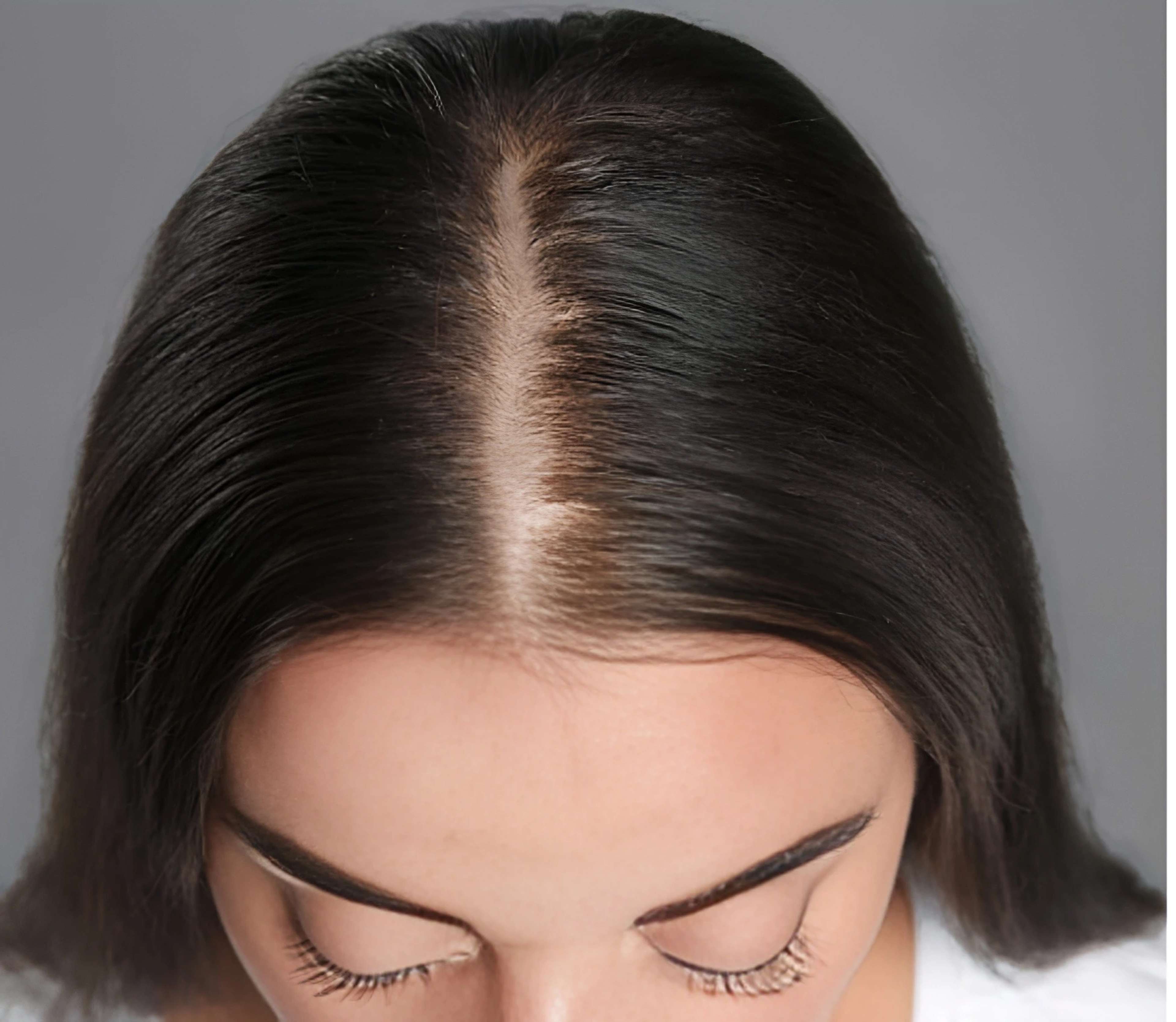 Hair wellness procedures Before