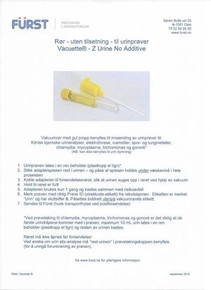 Bilde av veiledning for urinprøvetaking