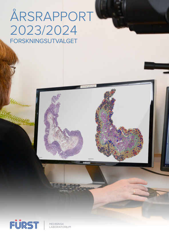 Bilde av forsiden til FOU årsrapport 2023-24 av patolog som ser på histologisk snitt