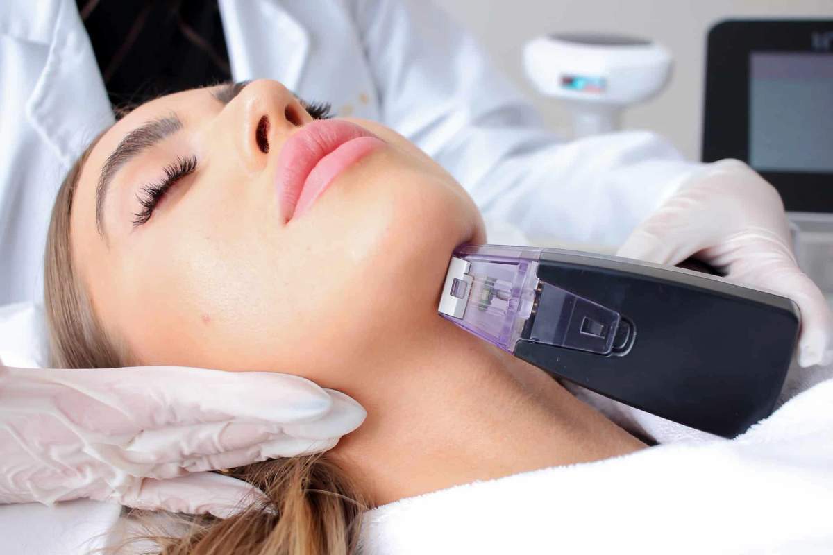 Morpheus8 handpiece on a patient’s jawline