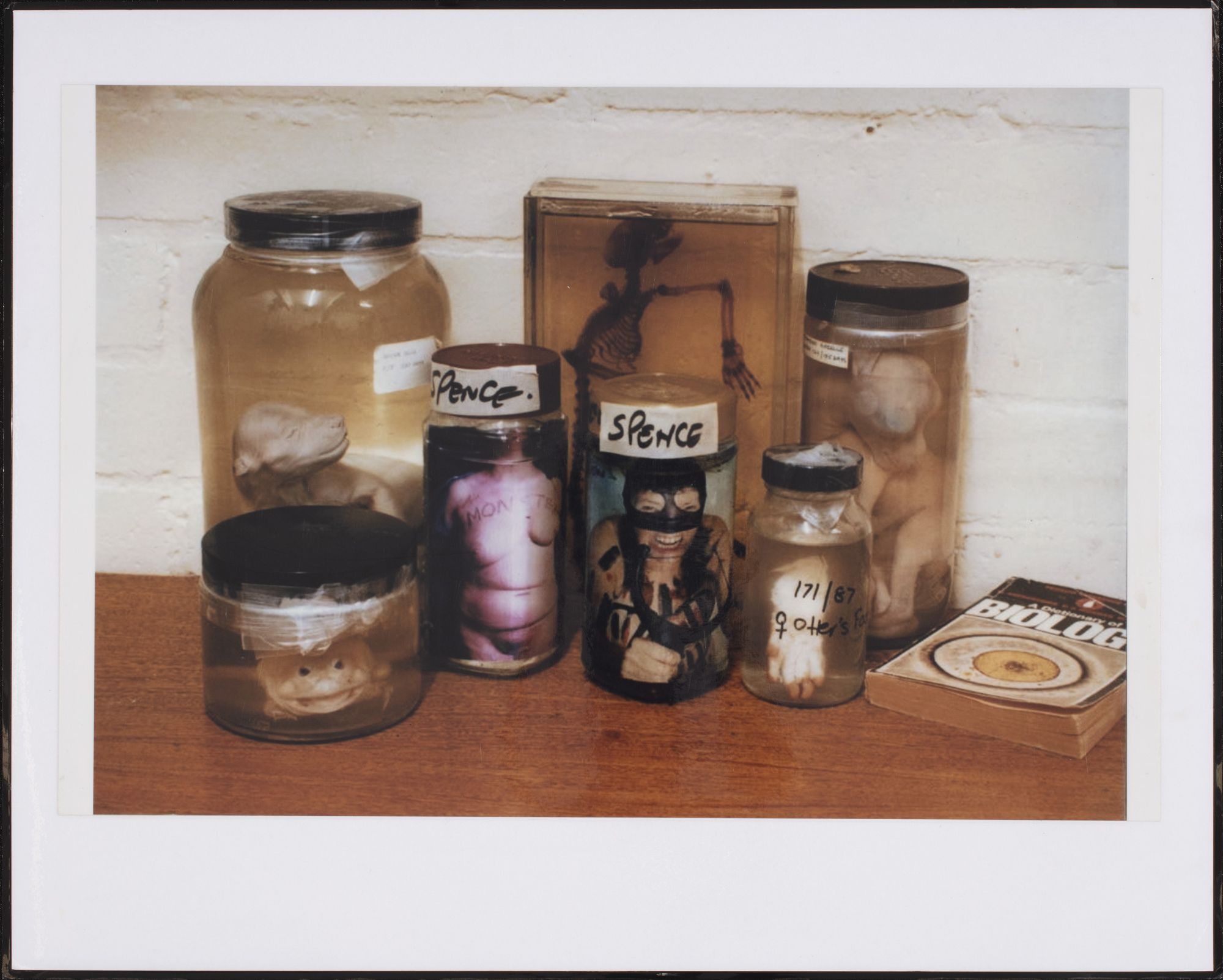 Jo Spence, The Final Project [Specimen Jars], 1991–92