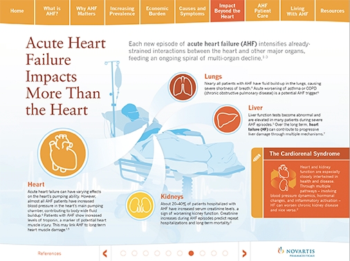 Novartis Acute Heart Failure Interactive Media Resource Page 7