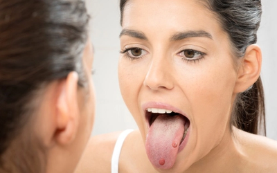 फोलेट (Vitamin B9) की कमी के लक्षण दिखाता ग्राफिक, जिसमें मुंह के छाले, जीभ में सूजन, थकान, एनीमिया और फोलेट से भरपूर खाद्य पदार्थ जैसे पालक, दालें और ब्रोकली दर्शाए गए हैं।