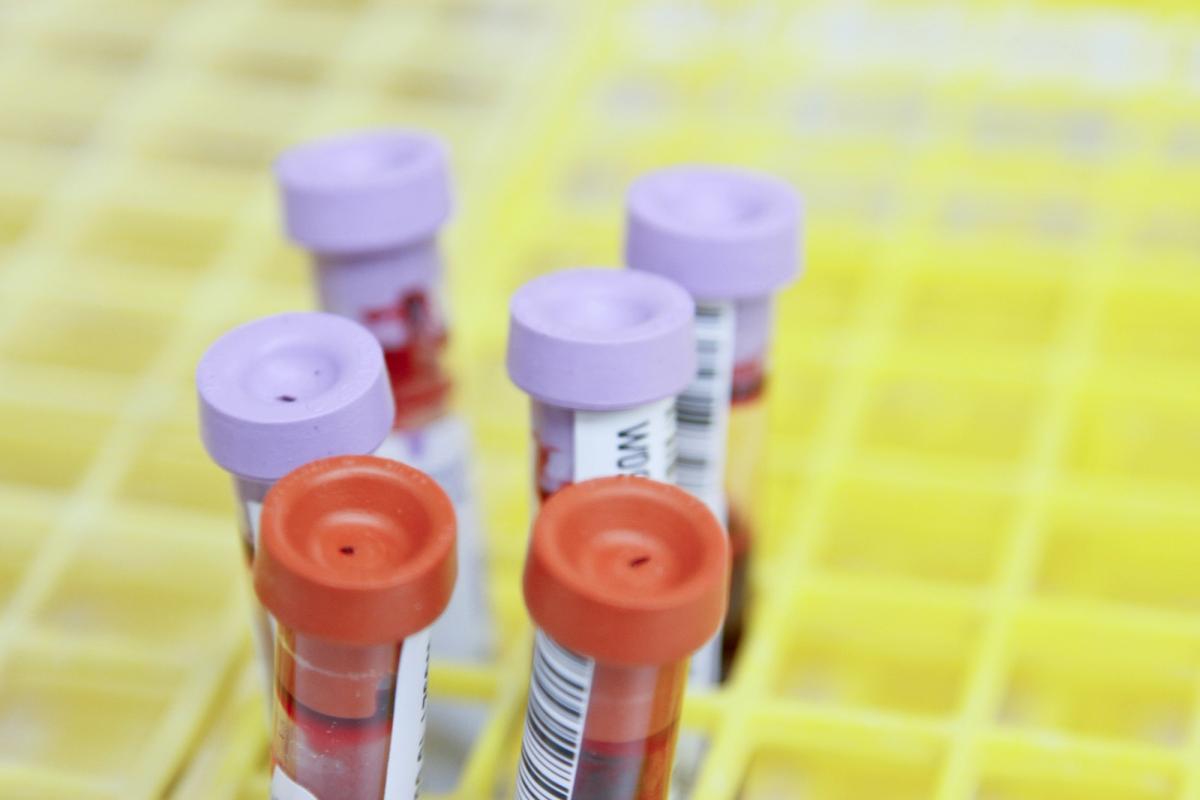 Free NHS blood type testing now available from Boots pharmacies