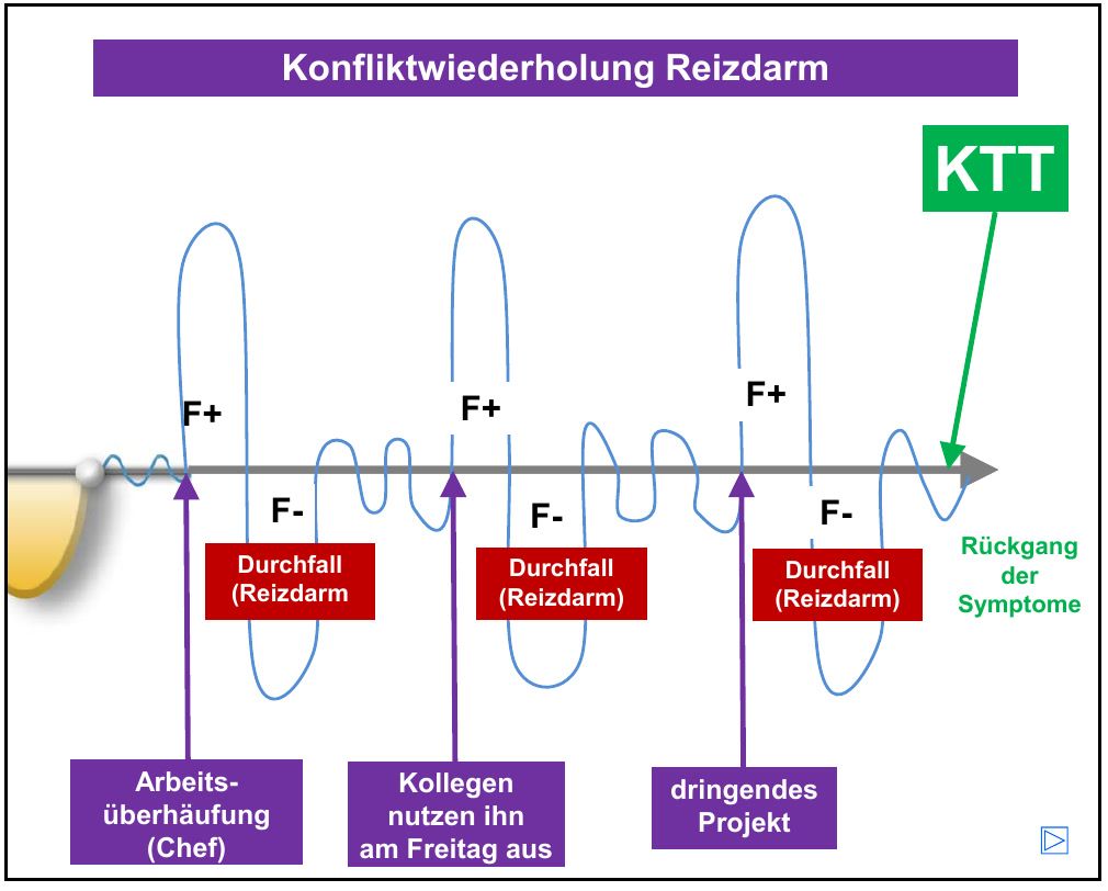 Verlaufskurve mit drei Wiederholungen: Arbeitsüberhäufung, Kollegen, dringendes Projekt, und jedes Mal Durchfall