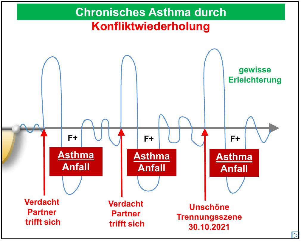 Verlaufskurve „Chronisches Asthma durch Konfliktwiederholung" mit drei Anfällen