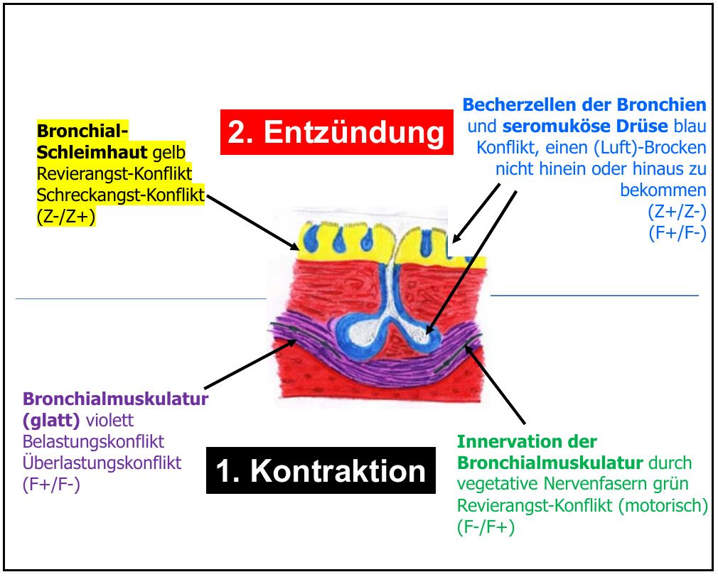 Querschnitt durch eine Bronchie mit Schleimhaut, Muskulatur und Drüsen (C Asthmapräsentation Rainer Körner)