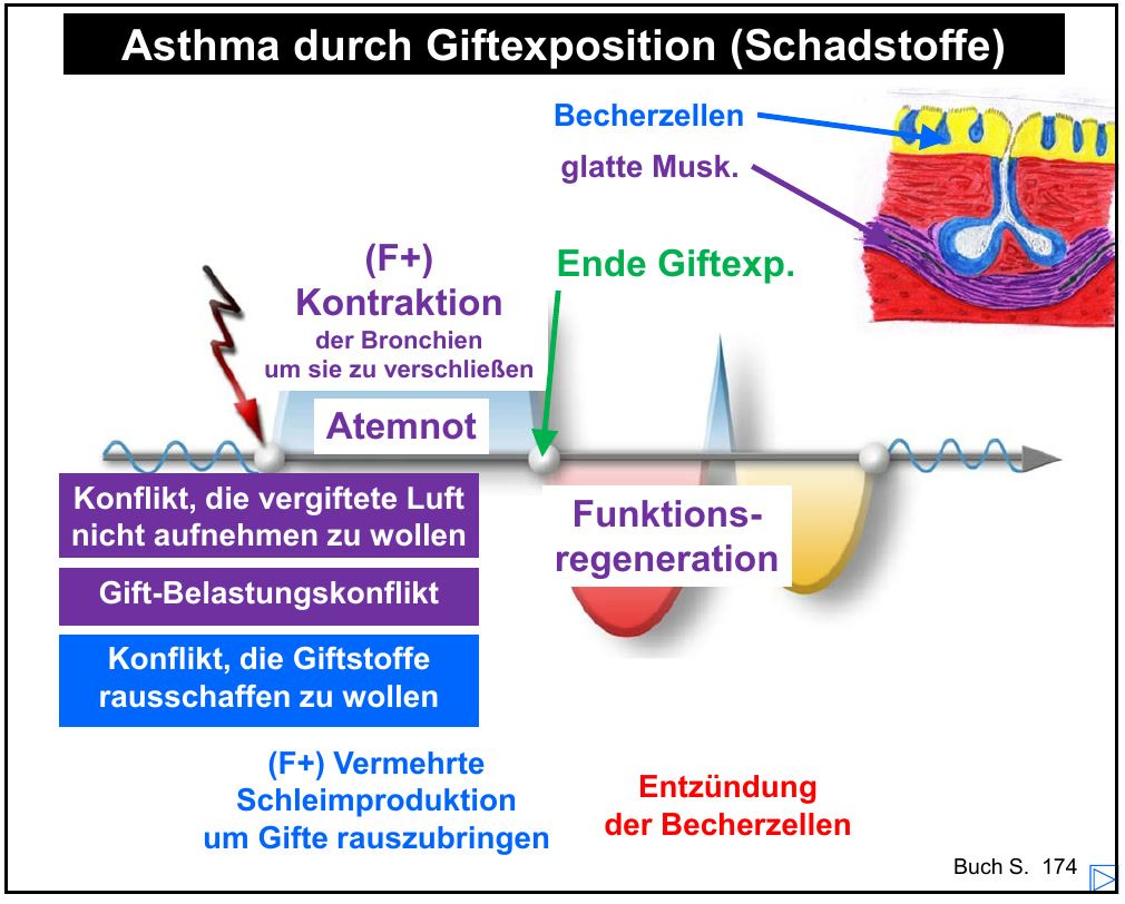 Verlaufskurve „Asthma durch Giftexposition" mit Kontraktion und vermehrter Schleimproduktion