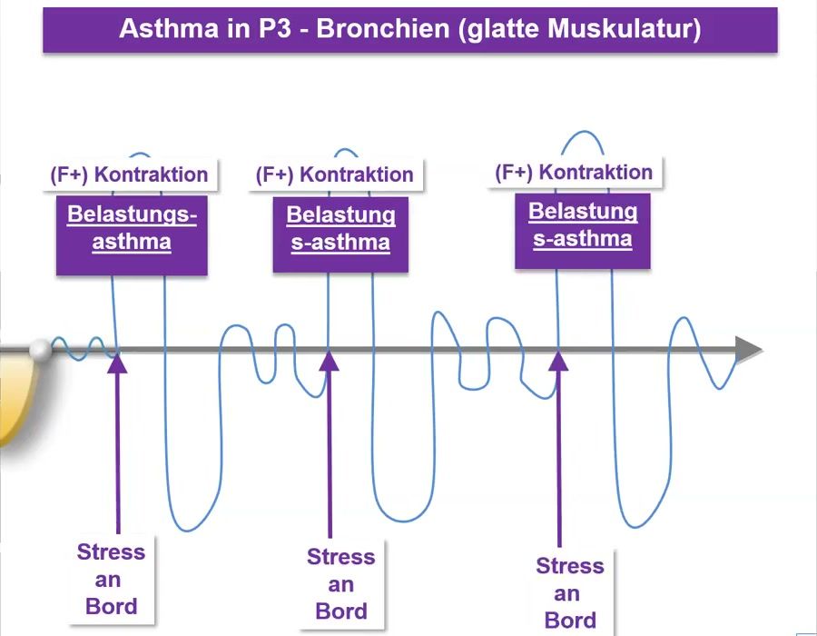 Konfliktkurve mit drei wiederholten Anfällen bei Stress an Bord