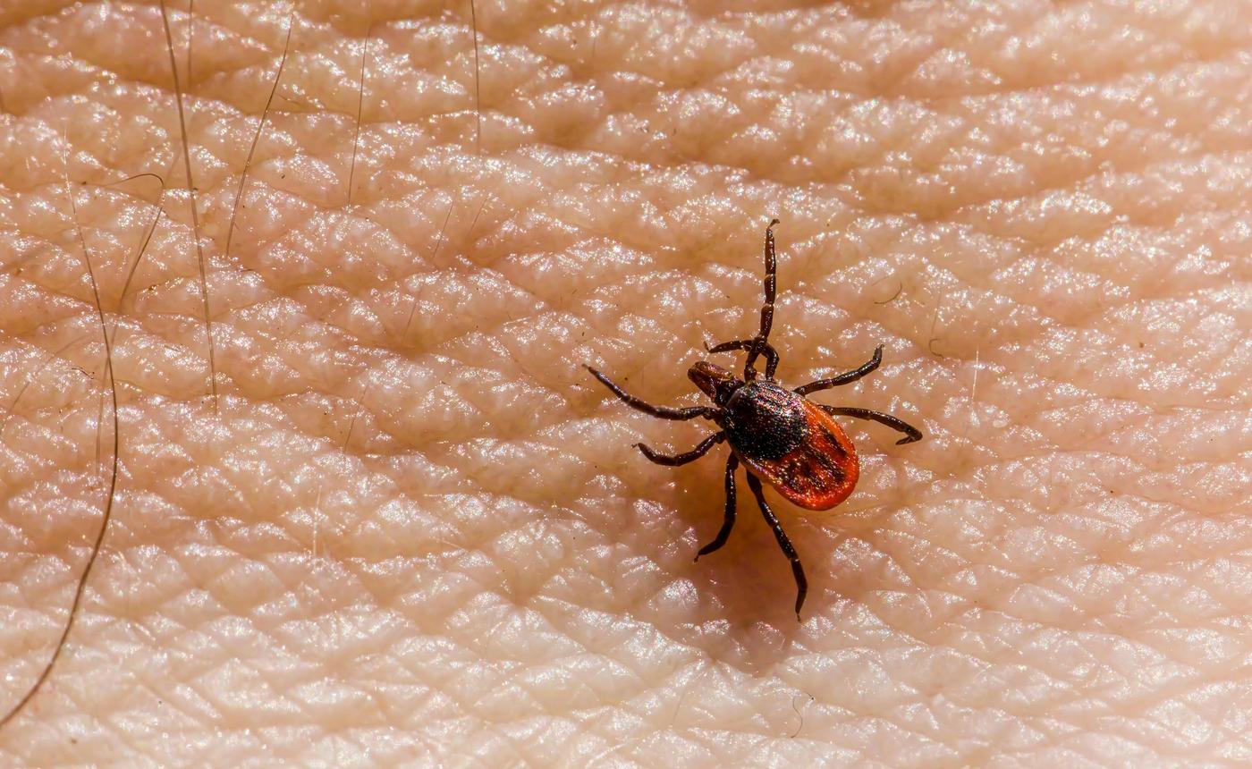 Enfermedad de Lyme