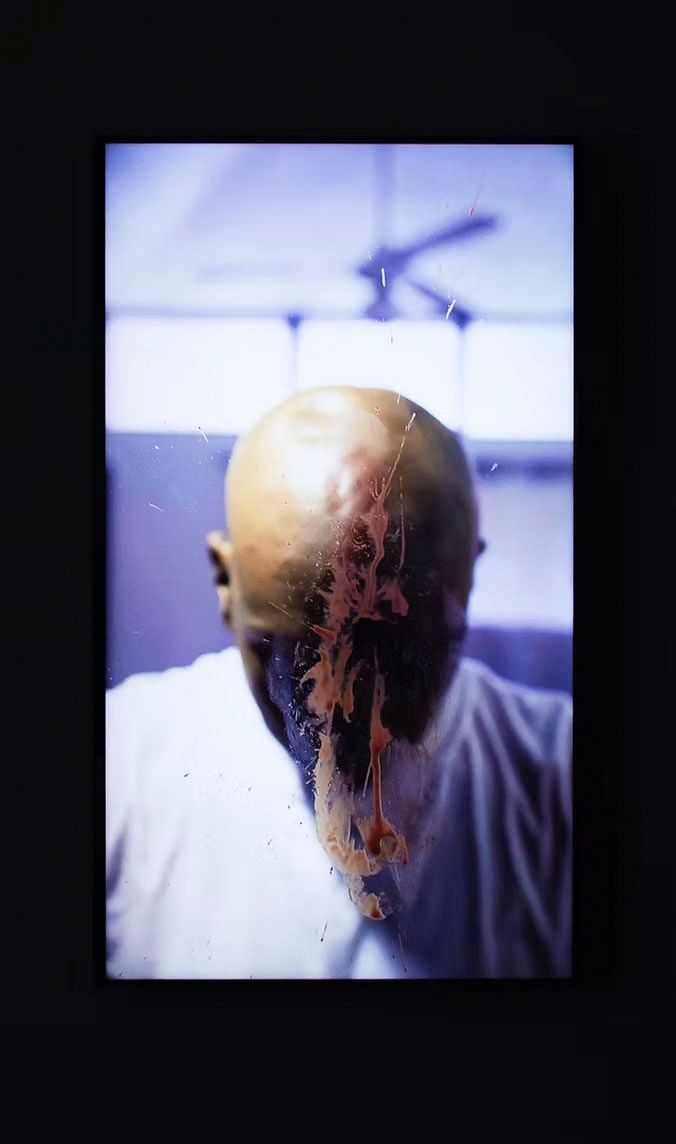 A framed image of a bald person seen from behind, with reddish-brown liquid splattered and dripping down their head and neck.