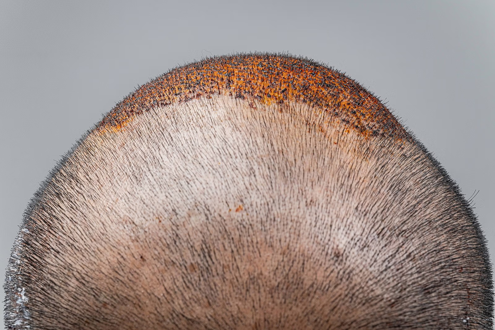 Asia and Latin America