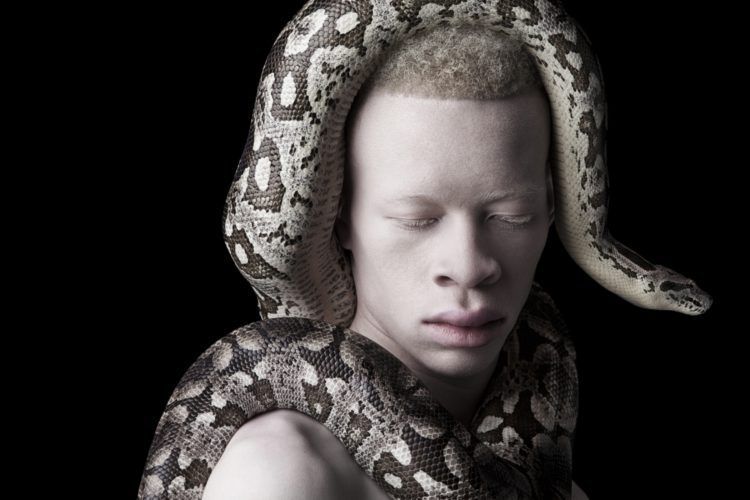 Justin Dingwall : Albus