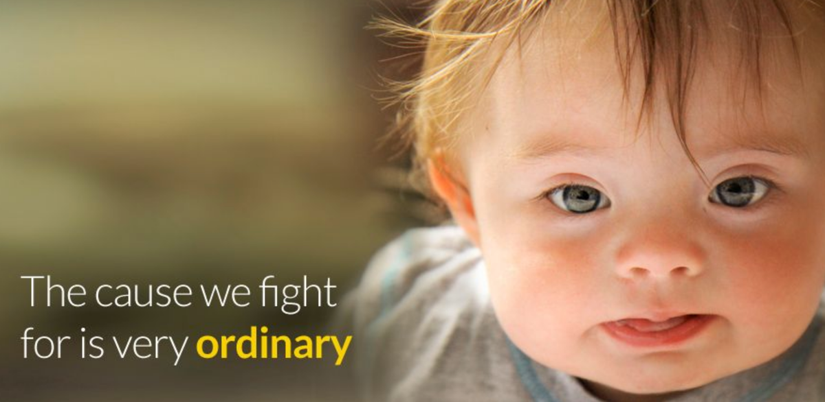 Baby with Down Syndrome, cause quote on left