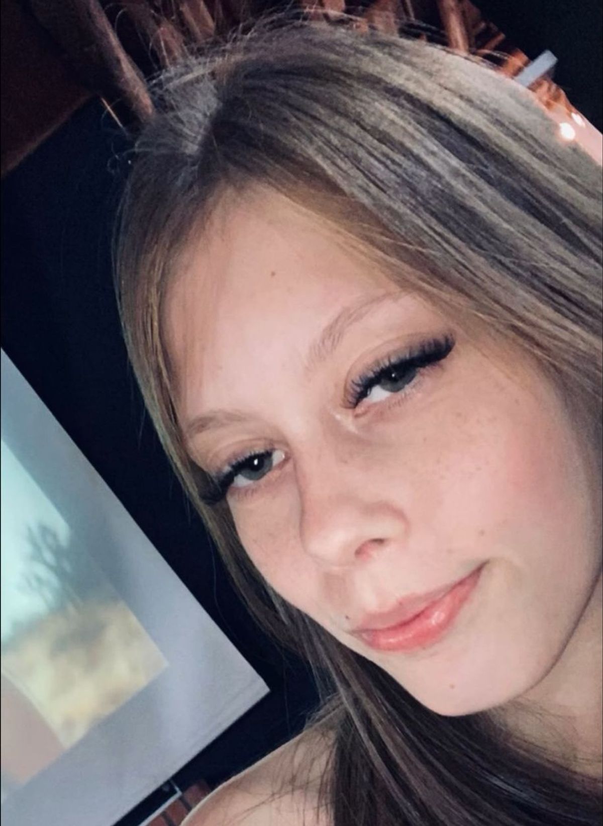 Morre jovem taioense de 18 anos que estava internada na UTI