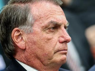 Defesa de Bolsonaro fala em piora de estado de saúde e pede laudo com urgência para prisão domiciliar