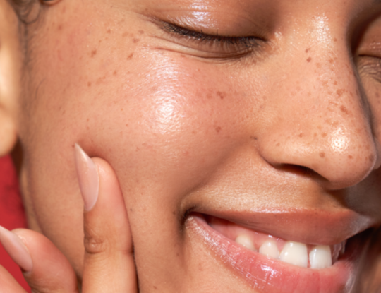 A smiling person with closed eyes and freckled, dewy skin touches their cheek.