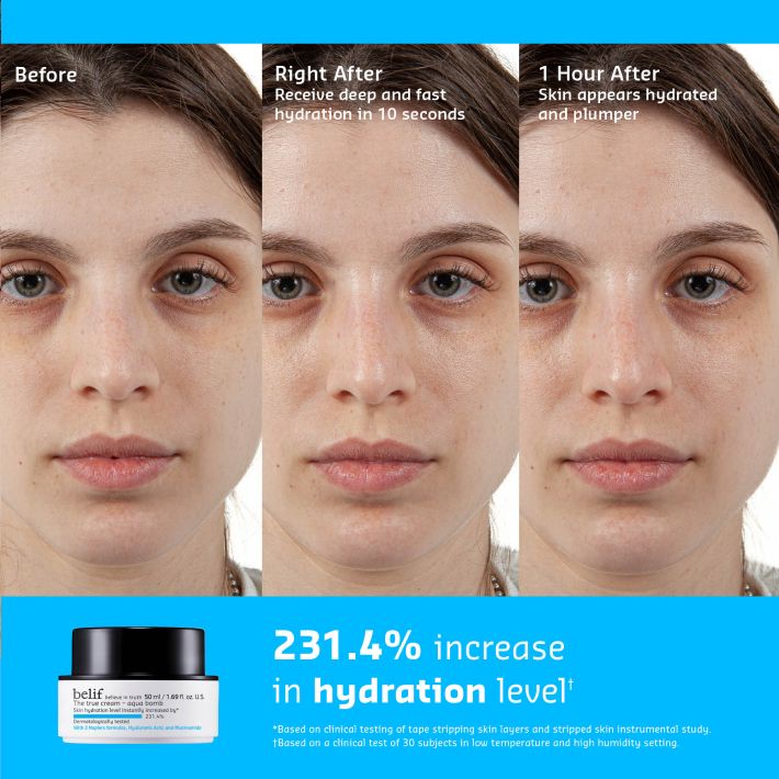 Three sequential close-up photos of a woman's face showing skin improvement: "before" with dry skin, "right after" post-application of belif Aqua Bomb Moisturizer, and "1 hour after" showing hydrated and plumper skin.