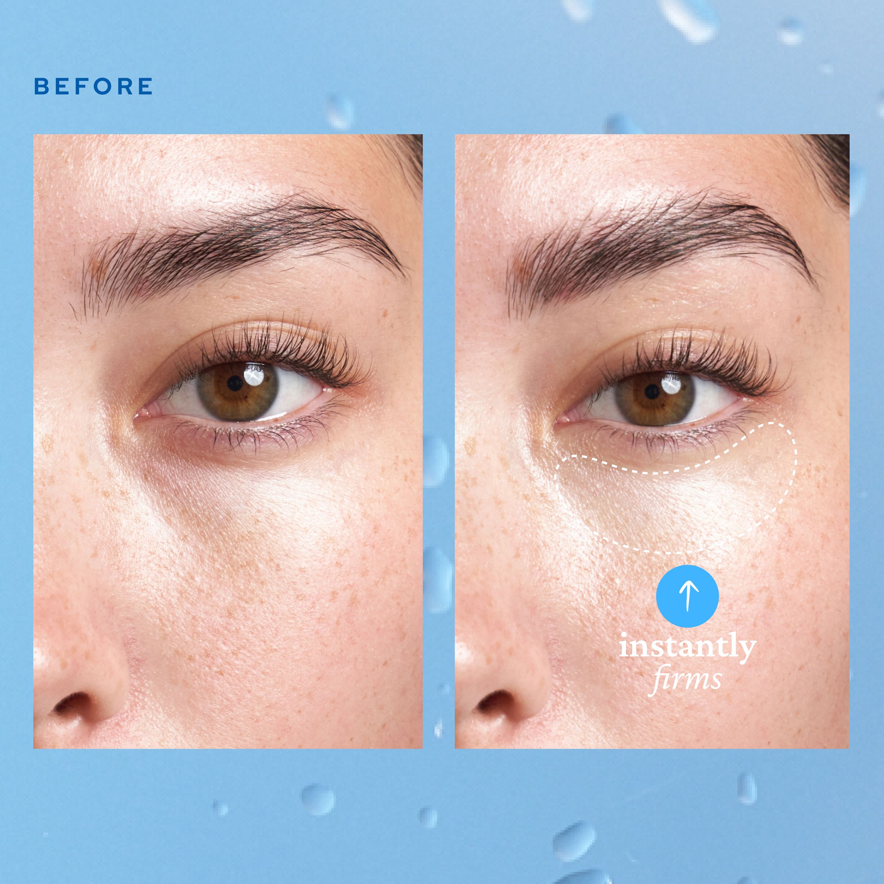 A split image showing "before" and "after" effects of belif Aqua Bomb Eye Gel on the under-eye area. The "before" side shows a close-up of an eye with visible puffiness, while the "after" side shows the same eye with firmer, smoother skin labeled "instantly firms.