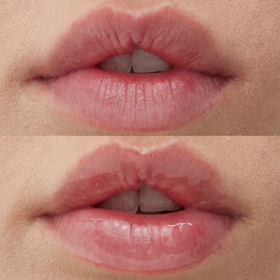 A horizontal top-to-bottom before and after of a woman's lips with and without Super Knights Lipcerin.