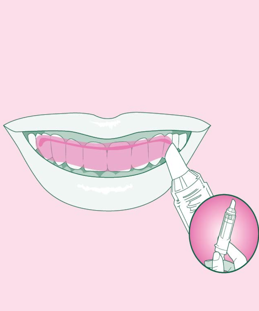 A schematic image of Euthymol Whitening Gel being applied to the teeth on pink background.