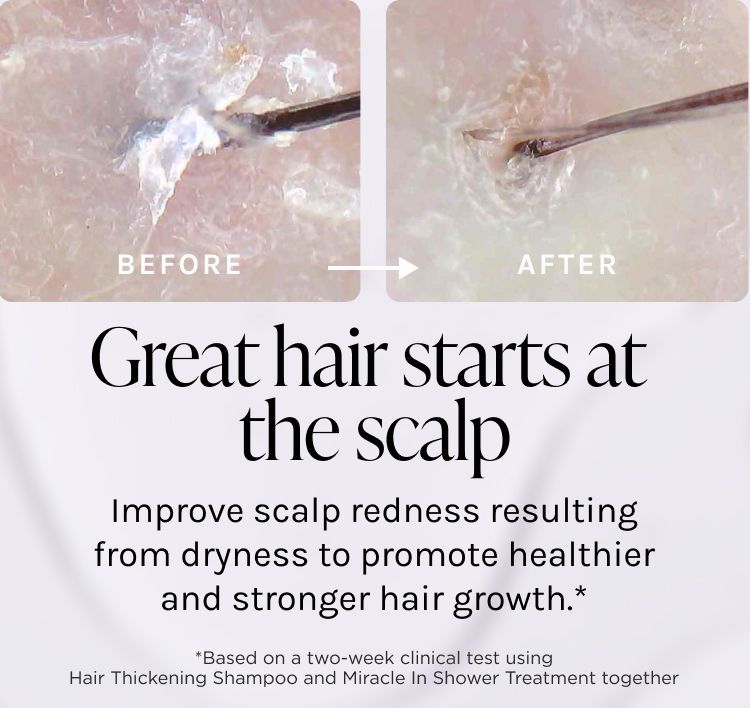 Scalp Revitalizing Solution Miracle in Shower Treatment - Dr