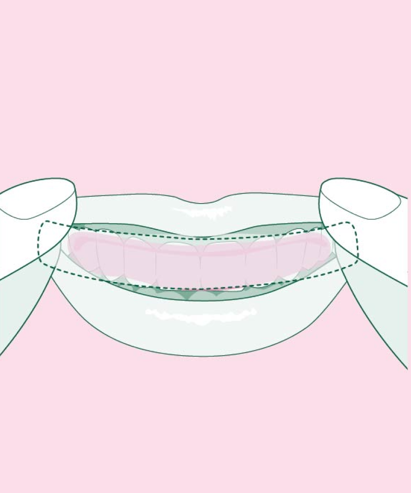 A schematic image of Euthymol Whitening Strip being applied to the teeth on pink background.