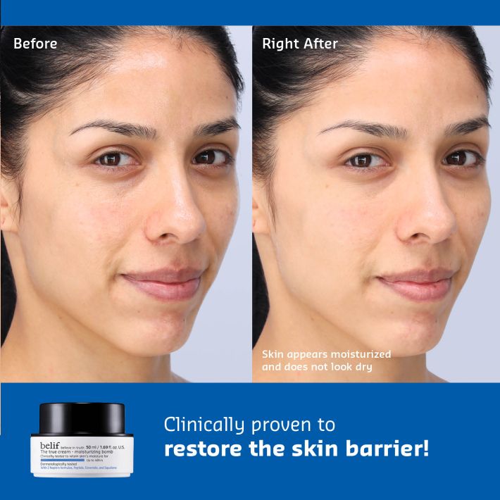 A split image labeled "before" and "right after" shows a woman's face. In the "before" image, her skin looks dry; in the "right after," it appears moisturized and not dry.